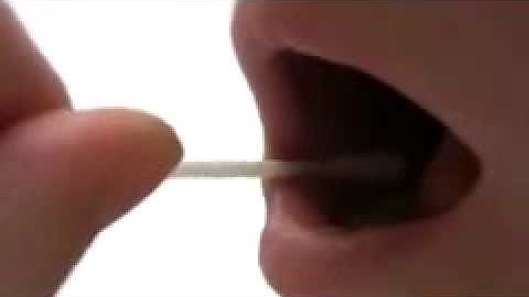 Hướng dẫn thu mẫu xét nghiệm ADN   mẫu niêm mạc miệng - gentis.com.vn