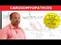 Cardiomyopathies - Causes & Symptoms - Cardiology