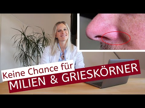 Video: Welche Creme ist am besten für Milien?