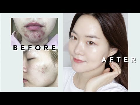 [eng] 피부가 좋아지는 팁 & 스킨케어 #조근조근 #asmr | My Current Skincare Routine & Tips #CALM AF