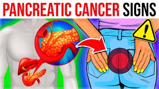 10 Crucial Warning Signs Of Pancreatic Cancer You Must NEVER Ignore