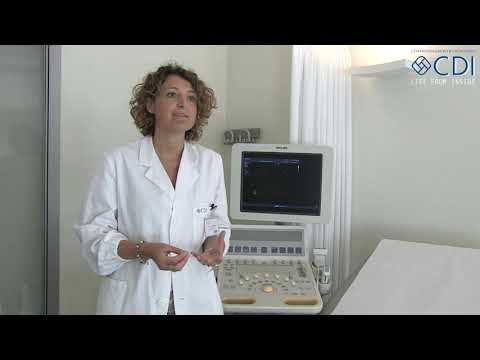 Video: Menopausa Prurito: Cause, Trattamento, Prevenzione E Altro