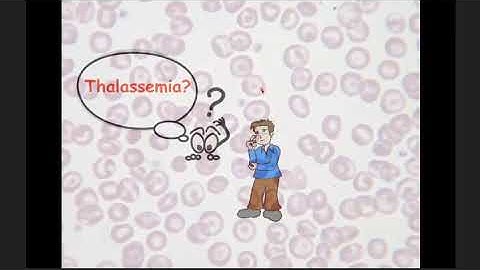 Hbe thalassemia là gì