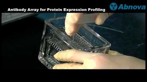 Antibody Array for Protein Expression Profiling