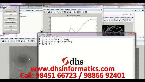 DHS MATLAB Projects An Enhanced Edge Detection Algorithm Distributed Canny Edge Method