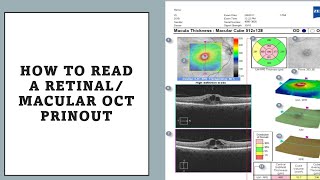 HOW TO READ MACULAR OCT PRINTOUT? made easy!!