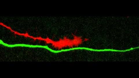 Sensory growth cone encountering an interjecting motor axon.
