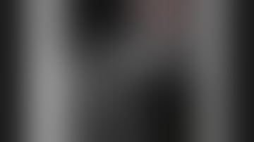 Surgical Clipping of an Unusual Ruptured M2 Aneurysm