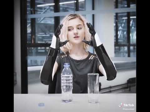 Tilly uses Esper Hands to drink water. Video by open Bionics