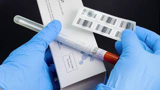 Halitest De Periolab Diagnóstico Avanzado De Halitosis Para Tu Clínica Dental