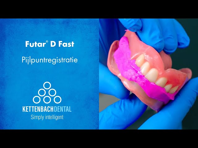 Pijlpuntregistratie met Futar® D Fast