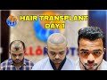 Hair Transplant | ALLoROOTs Bhubaneswar | DAY-1| @alloroots