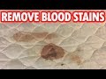 How To Get Blood Out Of Fabric