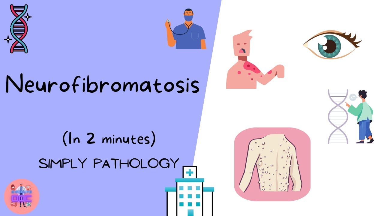 Neurofibromatosis | Simply Pathology | 2-minute doc | Med Vids Made Simple