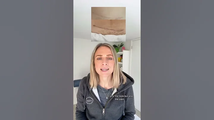 C-section recovery is here - https://the360mama.com/postnatal-recovery-programmes #postpartum