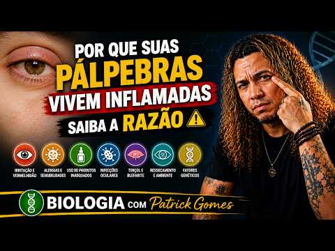 Por que suas pálpebras vivem Inflamadas - Saiba a RAZÃO