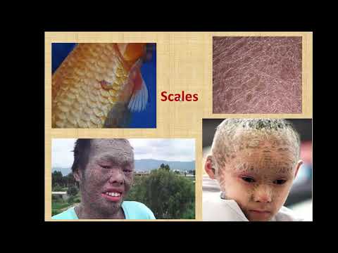 شرح أمراض العدوى الجلدية 2018 Dermatological Infections  الجزء 1 د. محمود سويلم