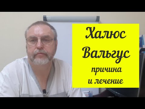 Халюс Вальгус (Hallux valgus). Настоящая причина данной проблемы.