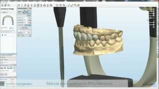 Dynamic Virtual Articulator
