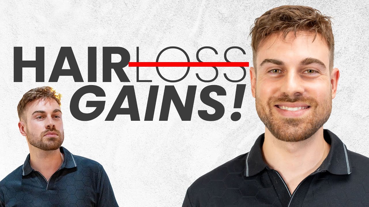 Hair Gains Stories | Life Before and After a Hair System