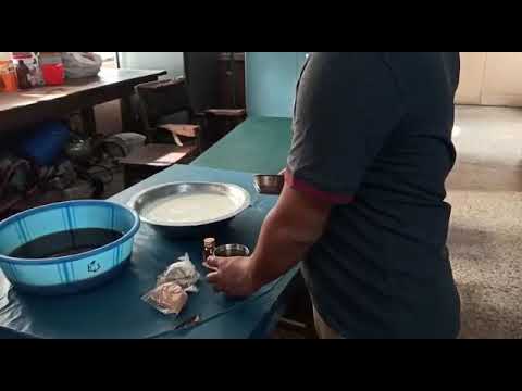 Ayurveda Vamana Therapy Part 5 Ayurvedic Treatment Vamana Kriya Ayurveda4Health Ayur