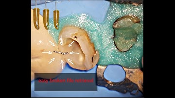 Broken File Retrieval Using Ultrasonic