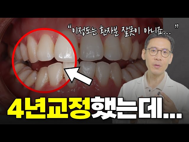 4년동안 교정했는데 교합이 안맞대요ㅠ l 재교정 전 후 사례