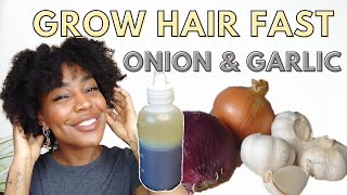 Onion And Garlic Hair Oil For Rapid Hair Growth And Reduce Hair Fall