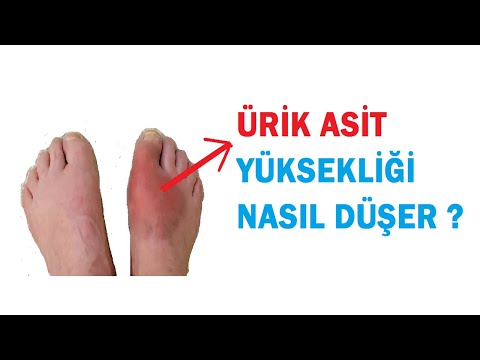 Video: Ürik Asit Testi Almanın 4 Yolu