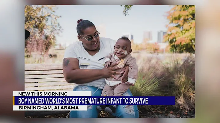 Alabama boy named world’s most premature infant to survive