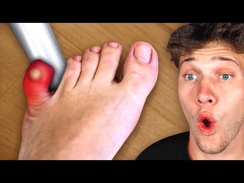 All Your Pain In One Video!