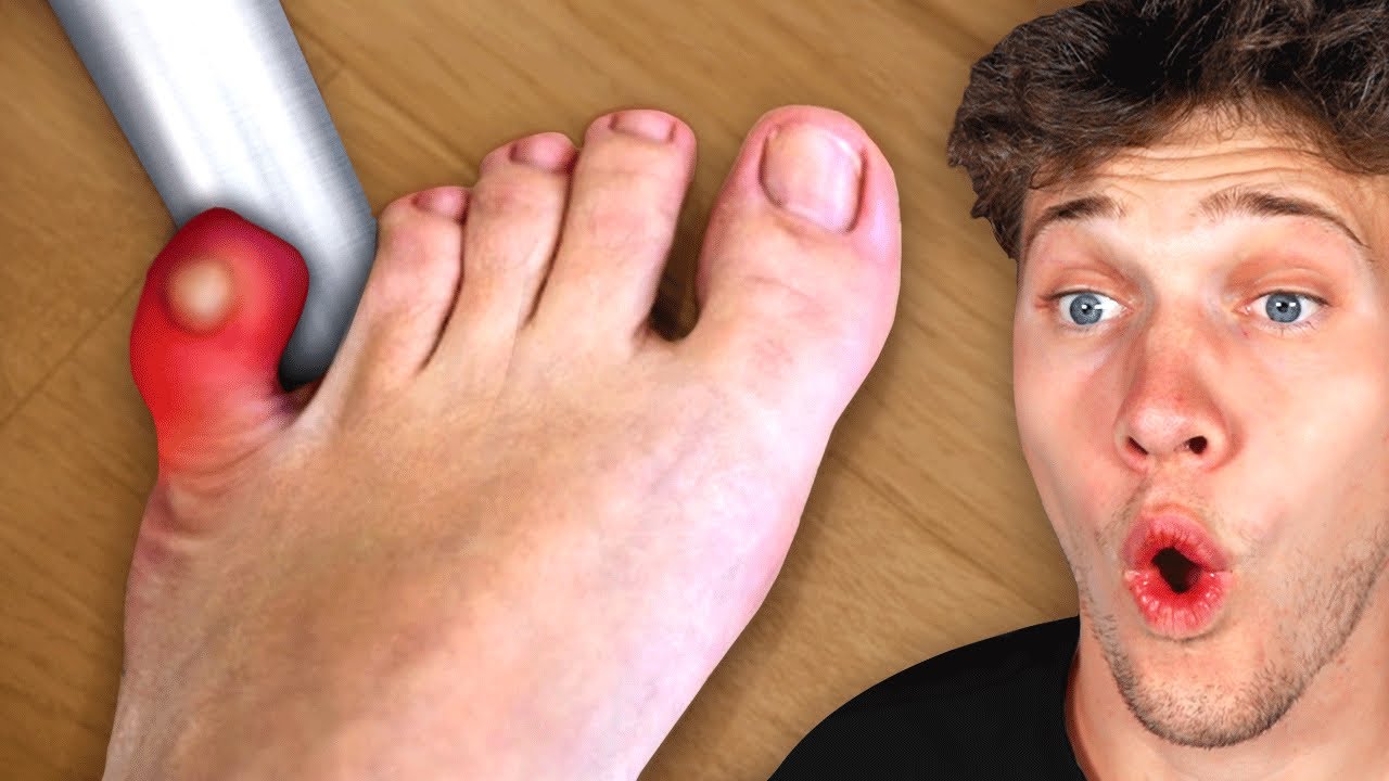 All Your Pain In One Video!