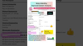 MALE INFERTILITY TREATED BY AYURVEDA AND PANCHKARMA