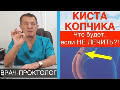 КИСТА КОПЧИКА - ЧТО БУДЕТ если НЕ ЛЕЧИТЬ?