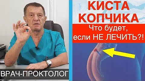 КИСТА КОПЧИКА - ЧТО БУДЕТ если НЕ ЛЕЧИТЬ?