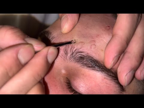 Excellent Relaxing Skin Care and Head Massage From Turkish Barber