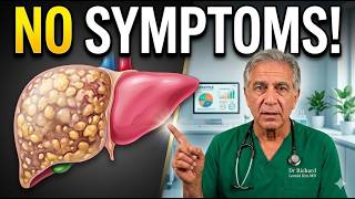 Most People Don’t Know They Have Fatty Liver Until It’s Too Late — Here’s How to Reverse It.