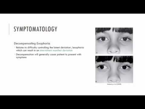 Exophoria - Characteristics