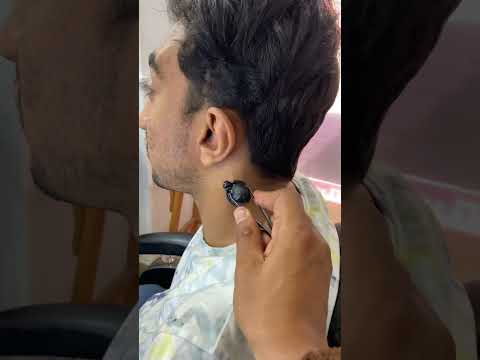 ازاله الحبايه المسرطنه السوداء