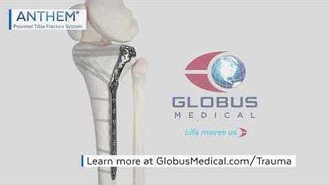 ANTHEM Proximal Tibia Plate Animation