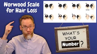 Norwood Scale for Hair Loss - Whats Your Number?