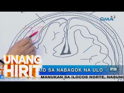 Unang Hirit: Ano ang dapat gawin kapag nauntog o nabagok ang ulo?