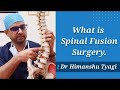 Spinal Fusion Surgery- What is it ?