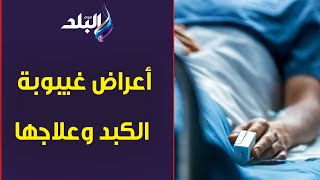 العيان ميكلش لحوم خالص .. الدكتور حسام موافي يوضح أعراض غيبوبة الكبد وعلاجها