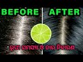 How to remove dandruff at home naturally rupi samasya o tar nibaran kemiti karibe