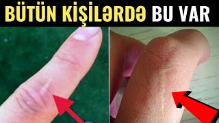 90 FAİZ KİŞİDƏ VAR - Sən Demə Bu Ləkə... 90 FAİZ KİŞİDƏ VAR - Sən Demə Bu Ləkə...