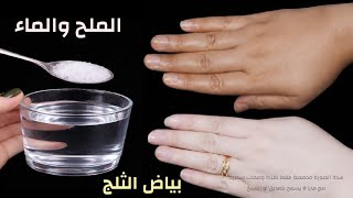 الملح والماء ‼️لتبييض فوري للجسم و الوجه في دقائق ‼️ضعيها علي السواد وستختفي screenshot 2