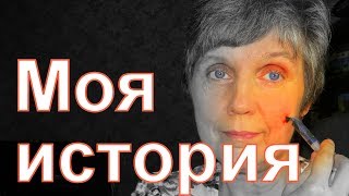 КАК ВЫЛЕЧИТЬ НЕВРАЛГИЮ ТРОЙНИЧНОГО НЕРВА ЗА 5 ДНЕЙ! ЛЕЧЕНИЕ ПИЯВКАМИ В ДОМАШНИХ УСЛОВИЯХ