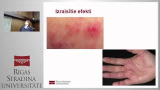 Naktsmītņu un sabiedriskās ēdināšanas nozarē izmantotās ķīmiskās vielas un svarīgākās prasības