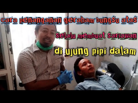 Geraham Bungsu Atas Yang Menimbulkan Sariawan di Pipi